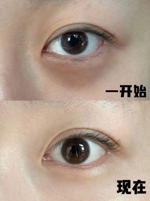 个牌子好？四款实力改善眼袋的眼霜分享OG真人平台25岁男士眼霜去眼袋哪(图1)