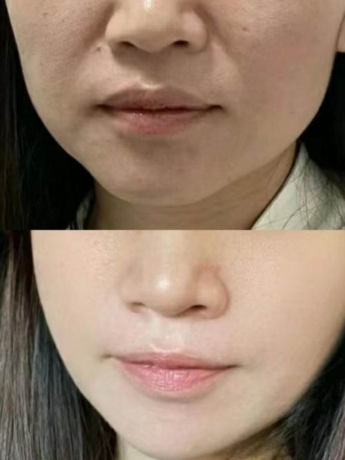 衰老护肤品总有一款你会喜欢！OG视讯总结：十大最有效抗(图1)