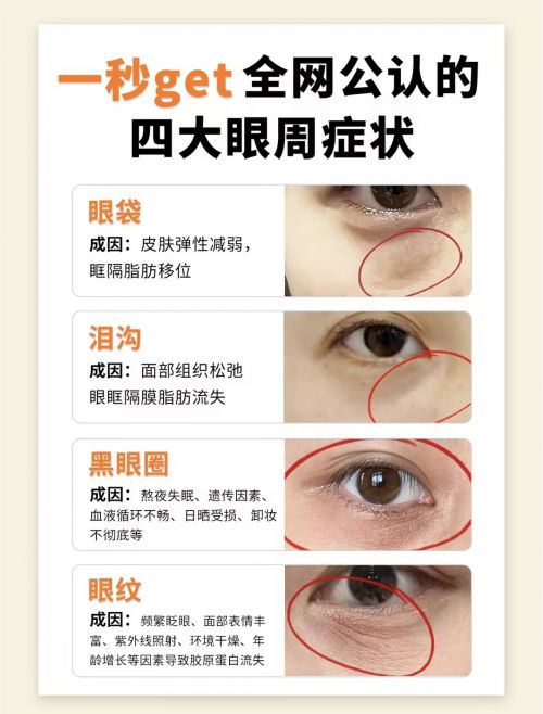 网公认效果好的十大去皱眼霜排行榜OG真人什么眼霜去皱效果好？全(图11)