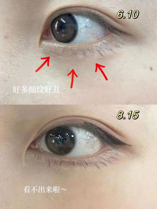 网公认效果好的十大去皱眼霜排行榜OG真人什么眼霜去皱效果好？全(图10)