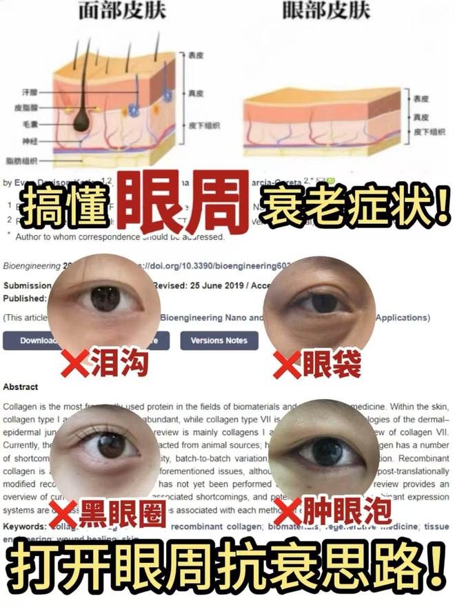 眼党救星2025抗皱眼霜榜单前十OG真人什么眼霜去皱效果好?垮(图2) 眼党救星2025抗皱眼霜榜单前十OG真人什么眼霜去皱效果好?垮(图2)